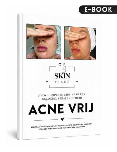 De Acne Gids | Het stappenplan naar een rustigere huid