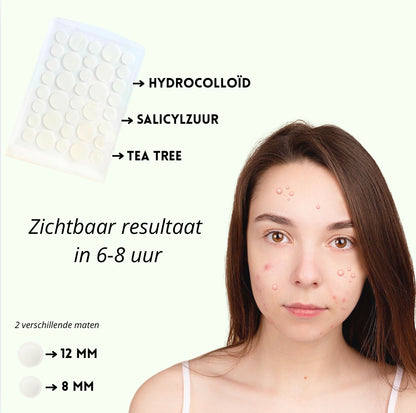 Pimple patches 36 stuks