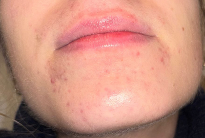 Before